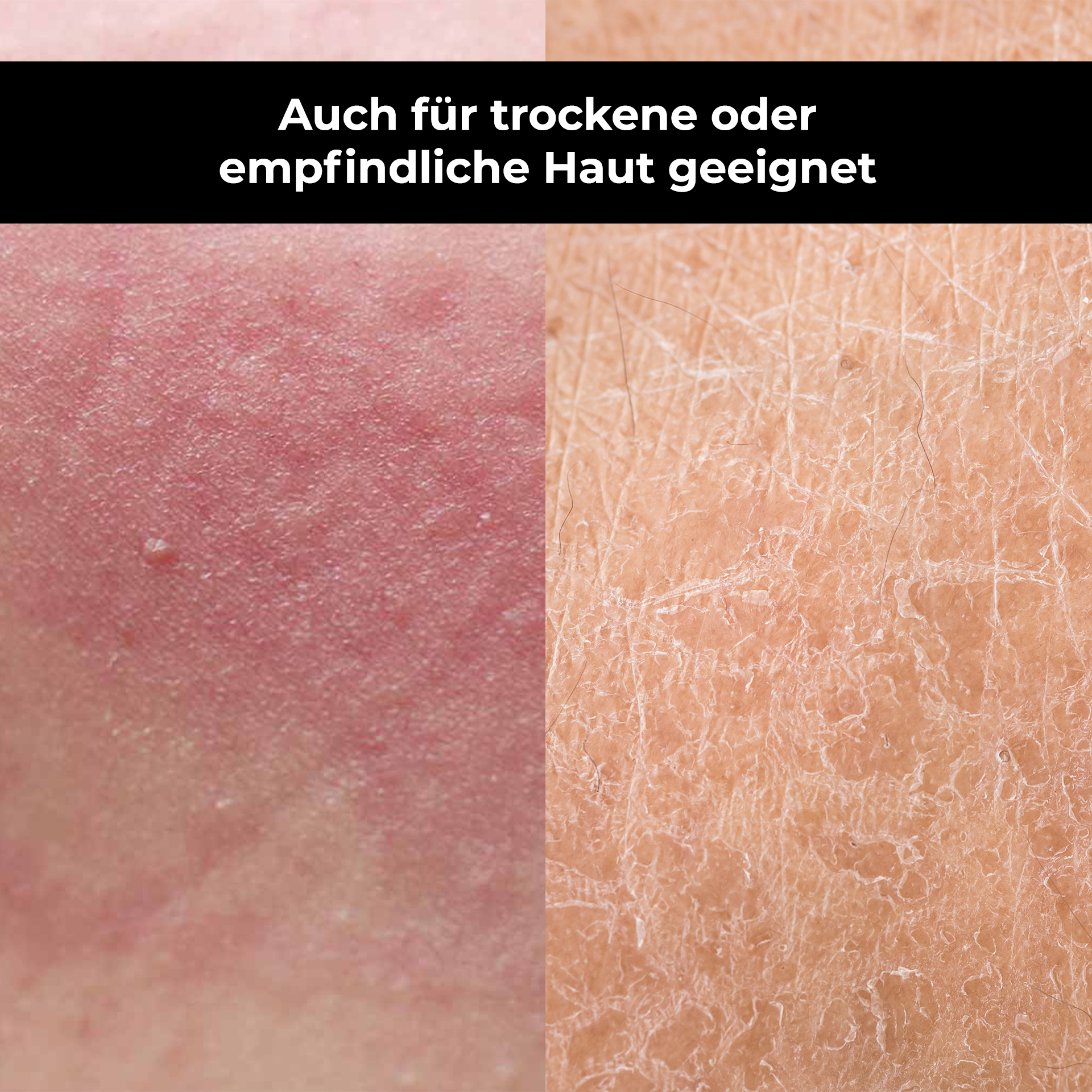 Person, Skin, Face, Head, Neck