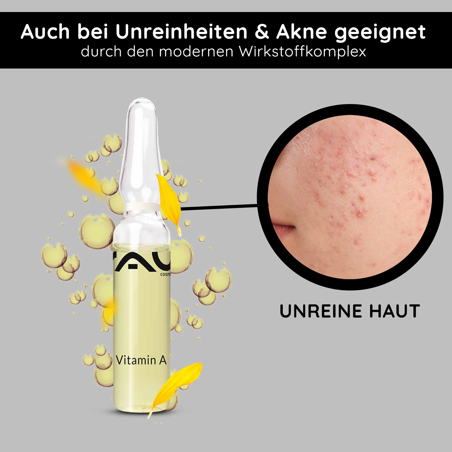 Vitamin A ampoules 10x2 ml for mature & blemished skin Ampulle mit Vitamin A von RAU Cosmetics, umgeben von Blasen, hervorgehoben für die Behandlung von unreiner Haut und Akne, mit dem Text "UNREINE HAUT" und gelben Blütenblättern.