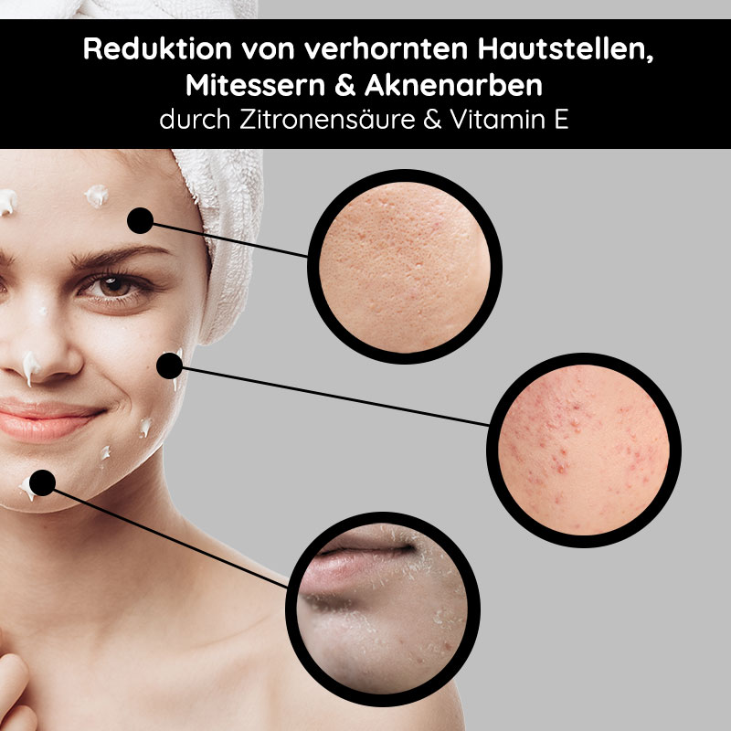 White Tea Silk Mask 200 ml Rich Cream & Mask Frau mit Gesichtsmaske, die Hautpflege und Reduktion von Mitessern und Aknenarben durch Zitronensäure und Vitamin E zeigt, mit Hautvergrößerungen zur Veranschaulichung der Ergebnisse.