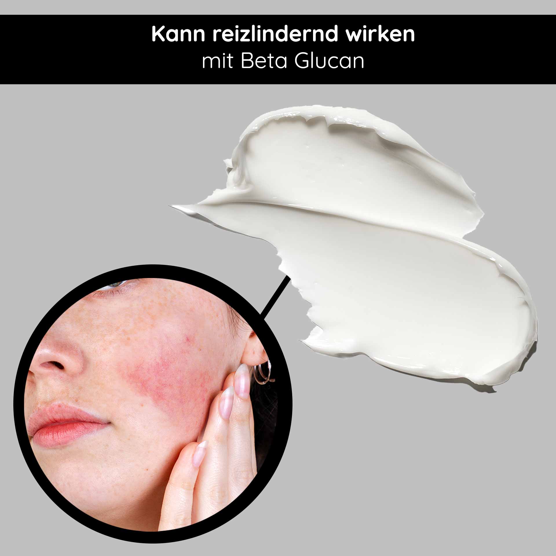 Beta Glucan Recovery Mask 200 ml Mascarilla para pieles irritadas Gesichtsmaske mit Beta Glucan, Anwendung zur Linderung von Hautirritationen, Nahaufnahme einer Person mit gereizter Haut und Creme.