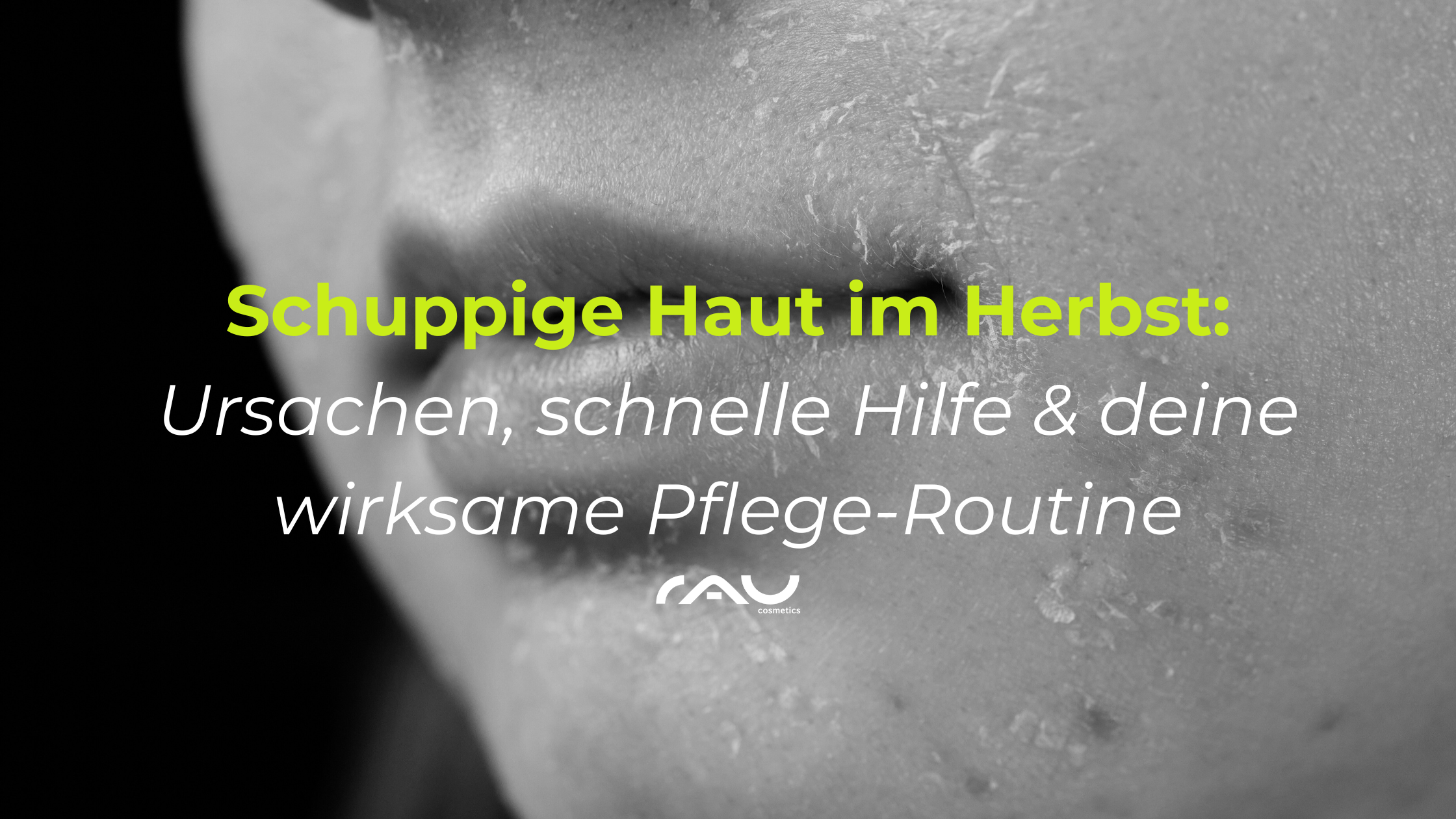 Schuppige-haut-blogpost Head, Person, Face