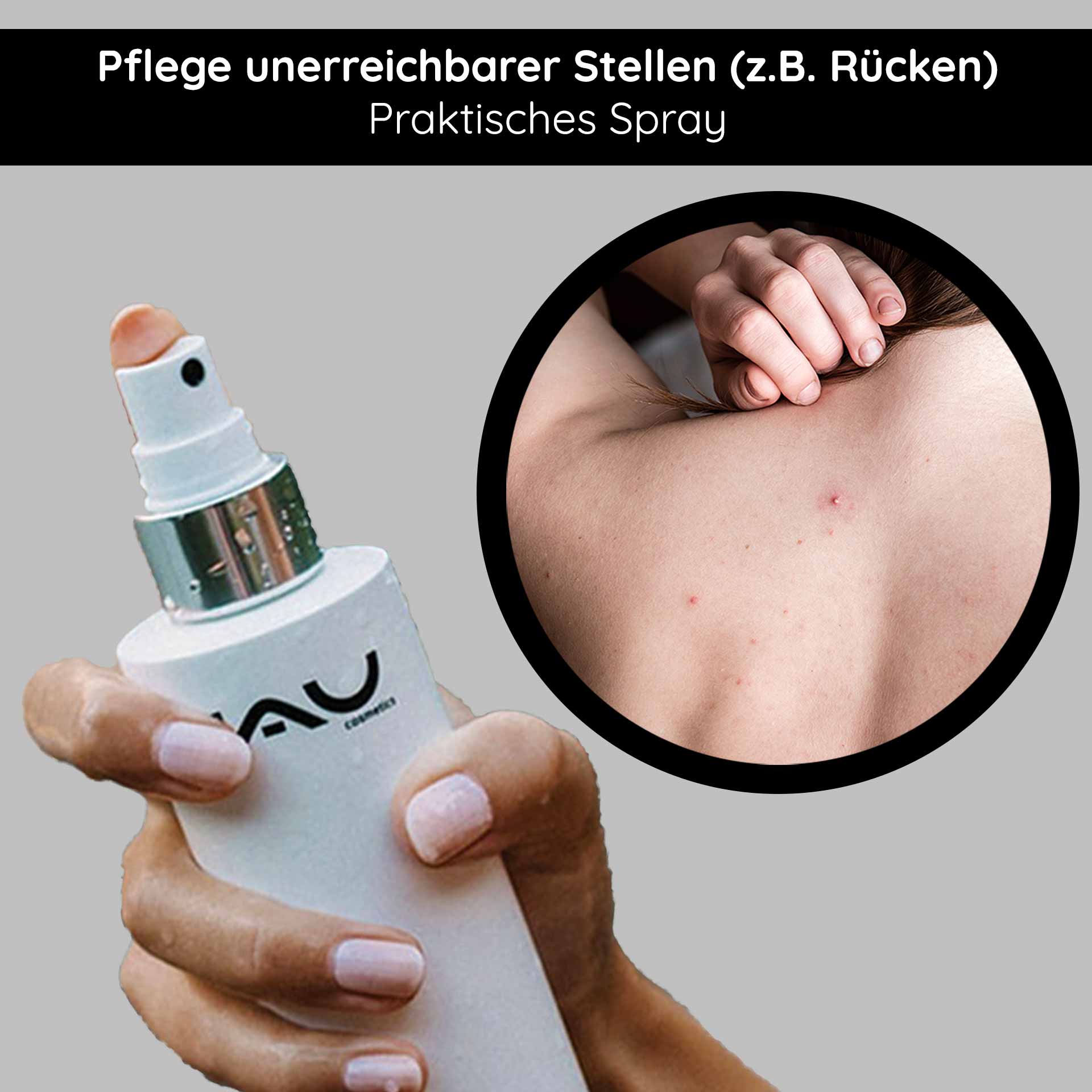 Silver Face & Body Spray 200 ml with Panthenol & Microsilver Halten Sie das RAU Cosmetics Silver Face & Body Spray in der Hand, das für die Behandlung schwer erreichbarer Bereiche wie dem Rücken entwickelt wurde und Vorteile bei Hautirritationen und Akne bietet.
