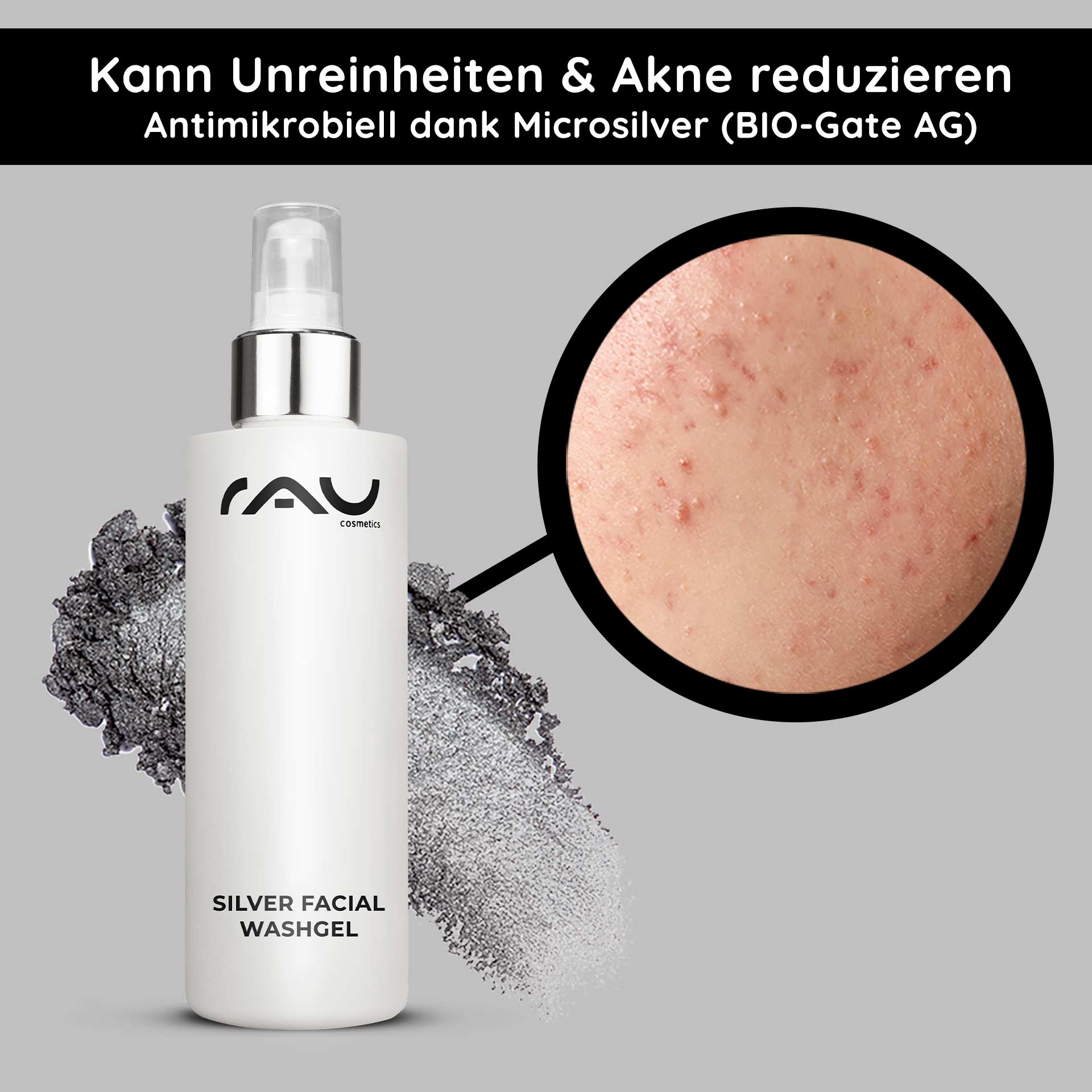 Gel limpiador facial de plata 200 ml Microsilver Cleanser Flasche RAU Silver Facial Washgel mit antimikrobiellem Mikrosilber, Nahaufnahme von Haut mit Akne und Unreinheiten, mit Hervorhebung der Vorteile für empfindliche und zu Akne neigende Haut.