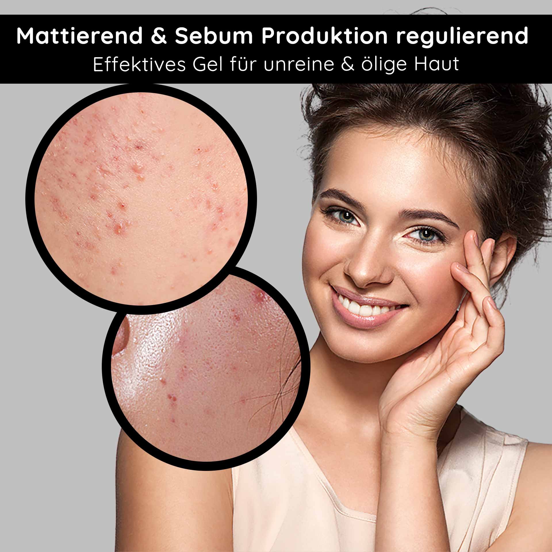 Mattifying gel for impure and oily skin, skin pores with impurities, smiling woman with healthy skin, focus on skincare and sebum regulation.