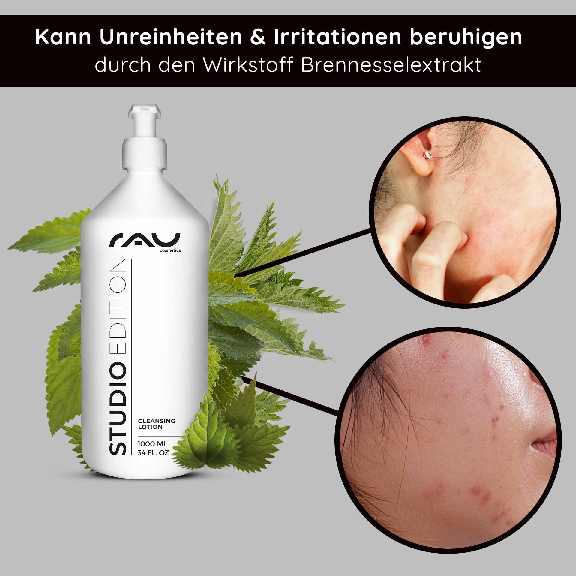 Frasco de loción limpiadora de RAU Cosmetics con extracto de ortiga, rodeado de hojas de ortiga, que resalta los beneficios para calmar las irritaciones e imperfecciones de la piel y enfatiza el cuidado natural de la piel.