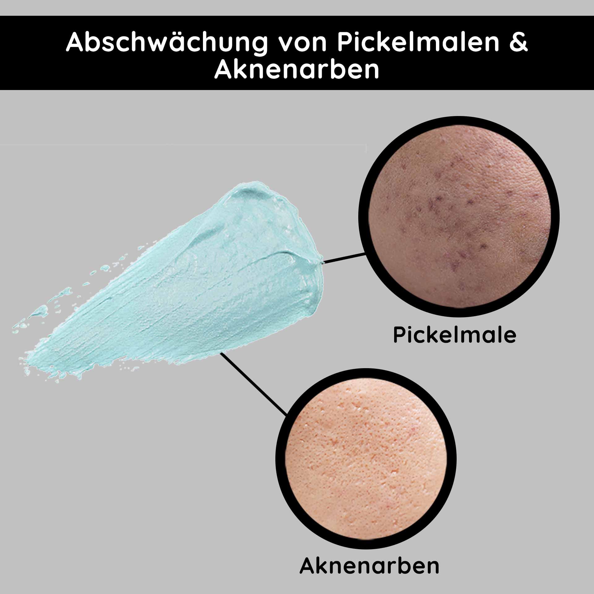 Abschwächung von Pickelmalen und Aknenarben mit blauer Creme, Vergleich von Hauttexturen für Hautpflegeprodukte.