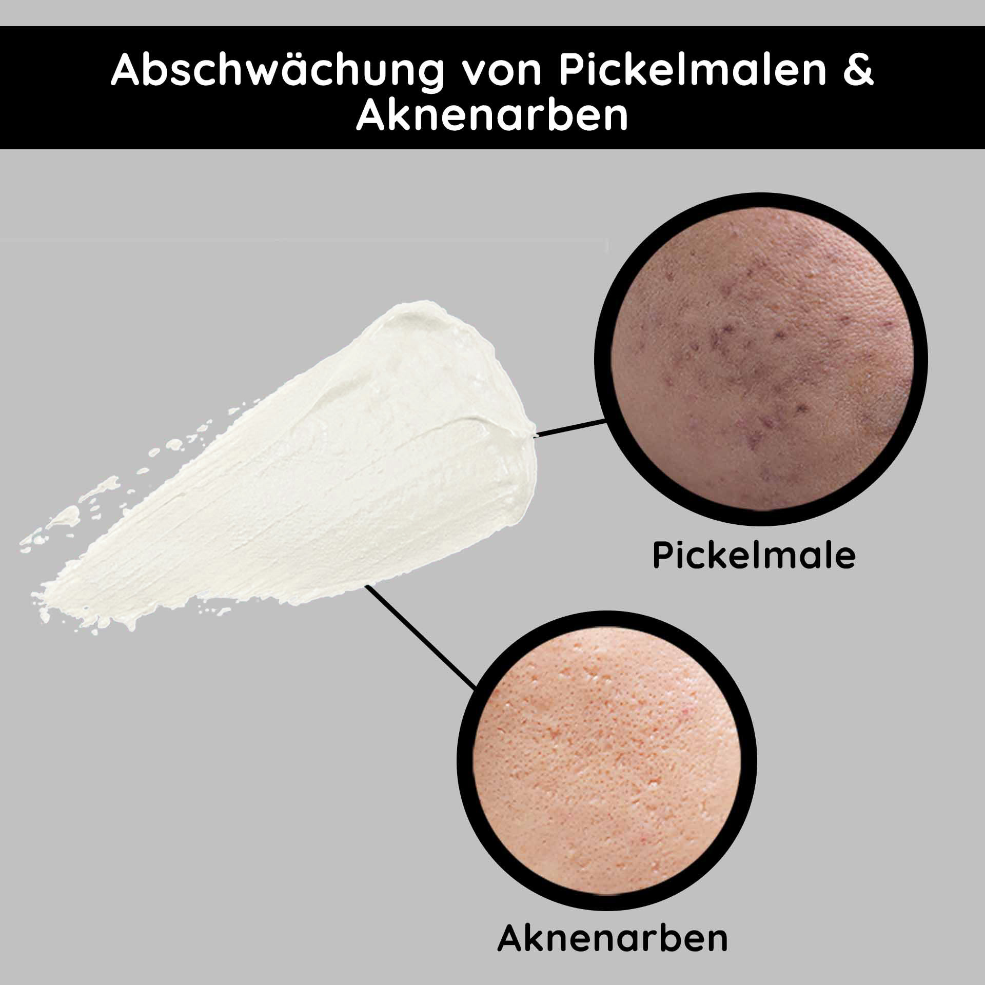 O2 Rich Cream 50 ml Rich night cream for dry skin with gingko Reichhaltige Nachtcreme von RAU Cosmetics zur Abschwächung von Pickelmalen und Aknenarben, mit Ginkgo-Extrakt für trockene Haut.