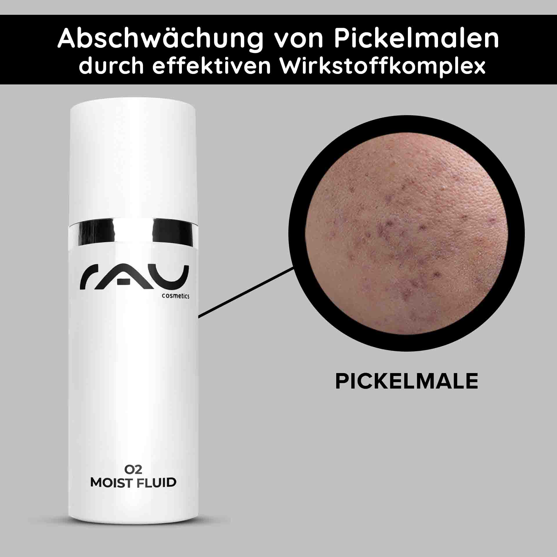 O2 Fluido Hidratante 50 ml Crema de día para cutis apagado RAU O2 Moist Fluid Hautpflegeprodukt mit sichtbarem Etikett und Nahaufnahme der Haut mit Aknenarben, wobei die Vorteile für fahle Haut und die Aknebehandlung hervorgehoben werden.