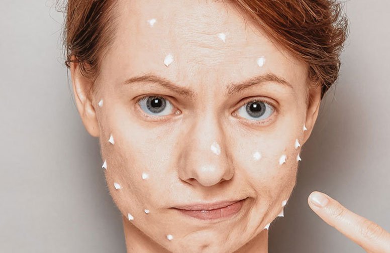 Hautpflege-Mythen_Gesichtspflege-Mythos-Pickel-Zahnpasta_02