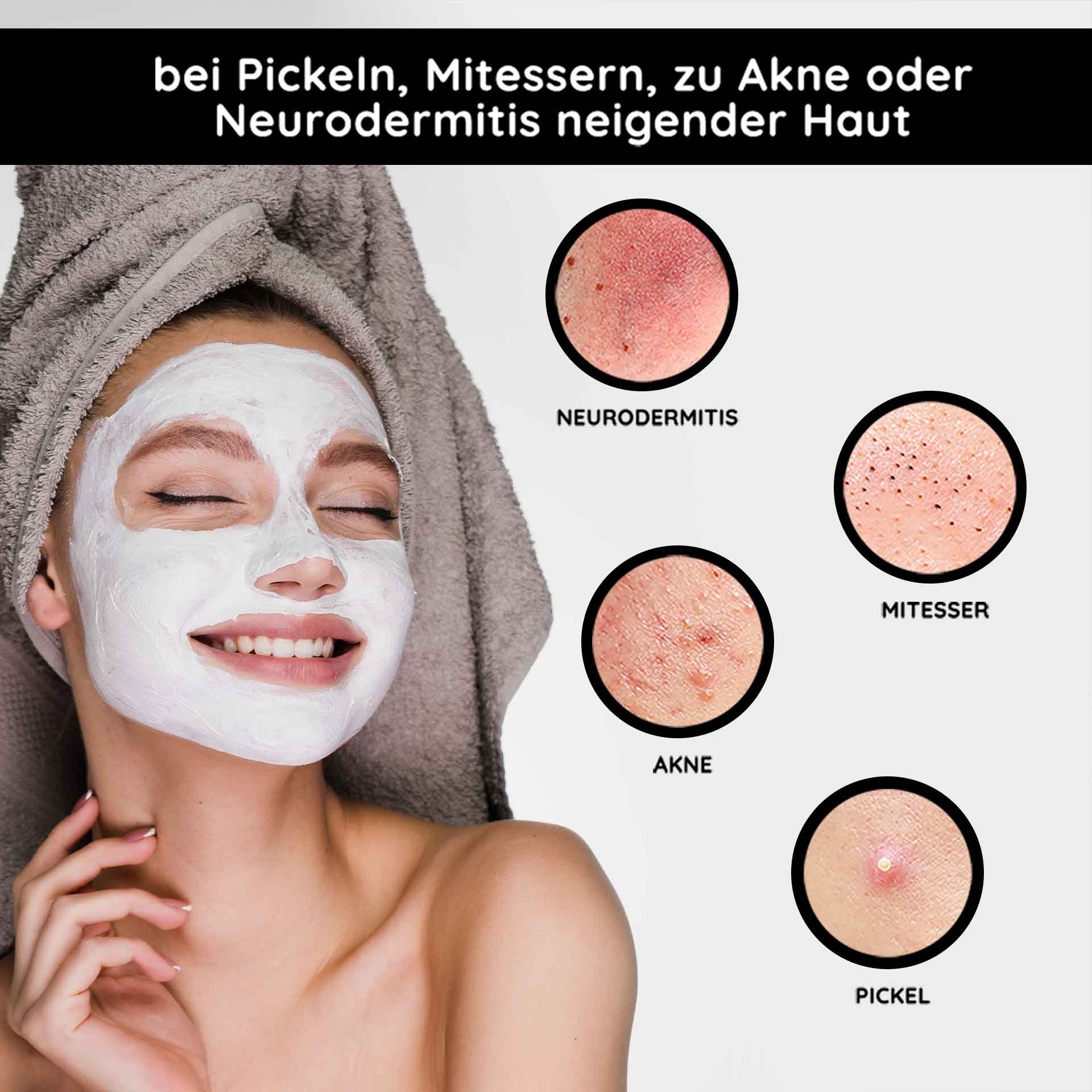 Mujer sonriente con una mascarilla facial para el cuidado de la piel, rodeada de imágenes de problemas cutáneos como acné, puntos negros y neurodermatitis, presentando los beneficios de la Mineral Mask de RAU Cosmetics para pieles problemáticas.