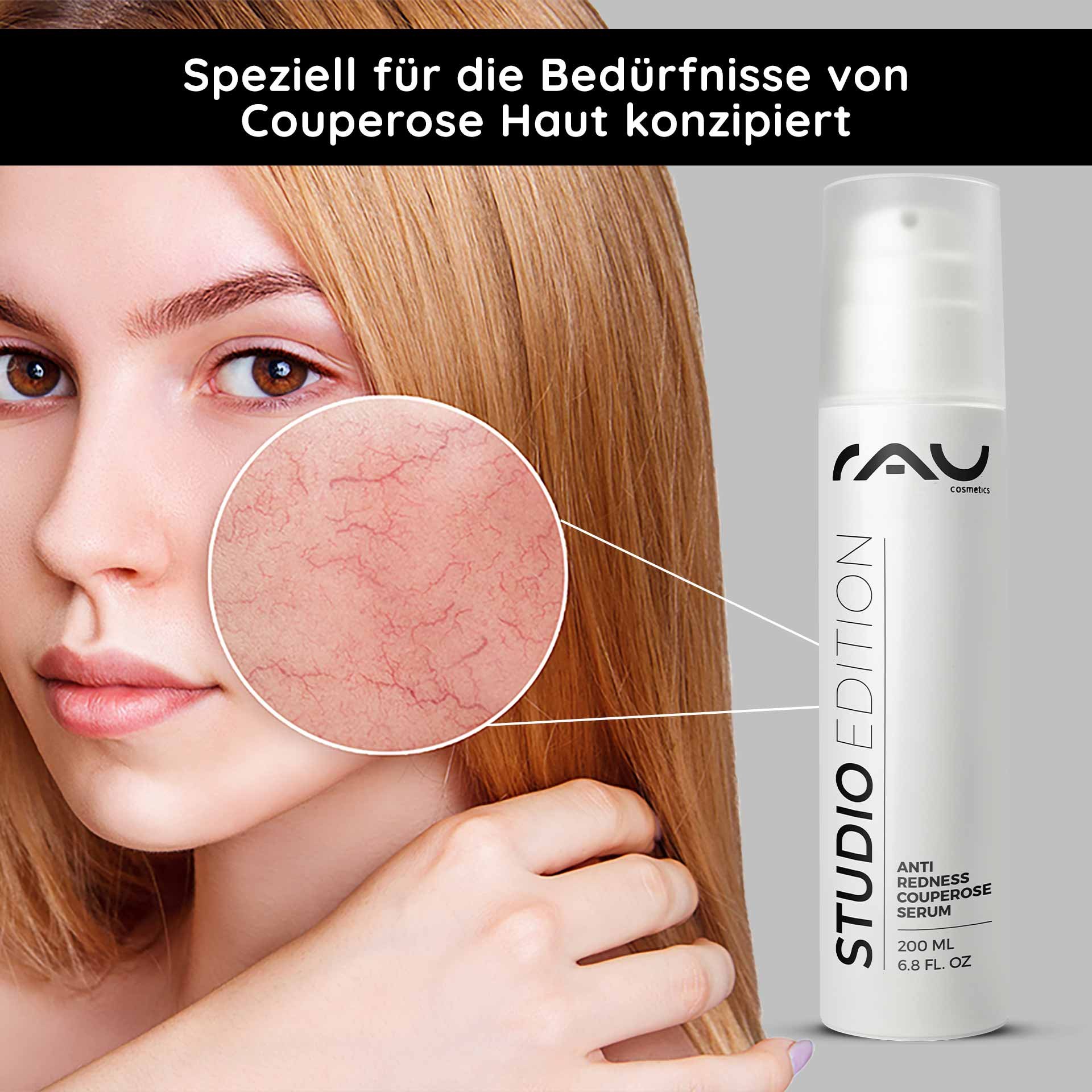 Anti-Redness Couperose Serum von RAU Cosmetics, entwickelt für empfindliche Haut, hebt Rötungen im Wangenbereich hervor, mit einer Produktflasche mit 200 ml Fassungsvermögen.