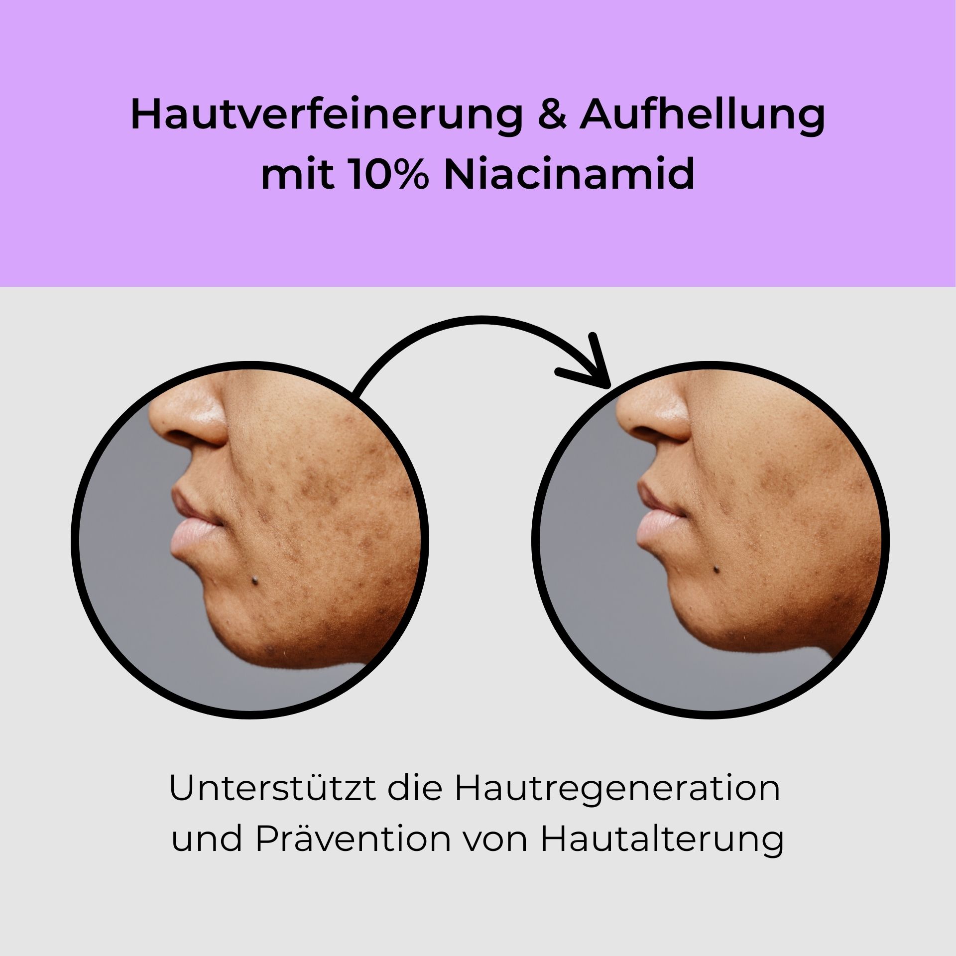 Head, Person, Face