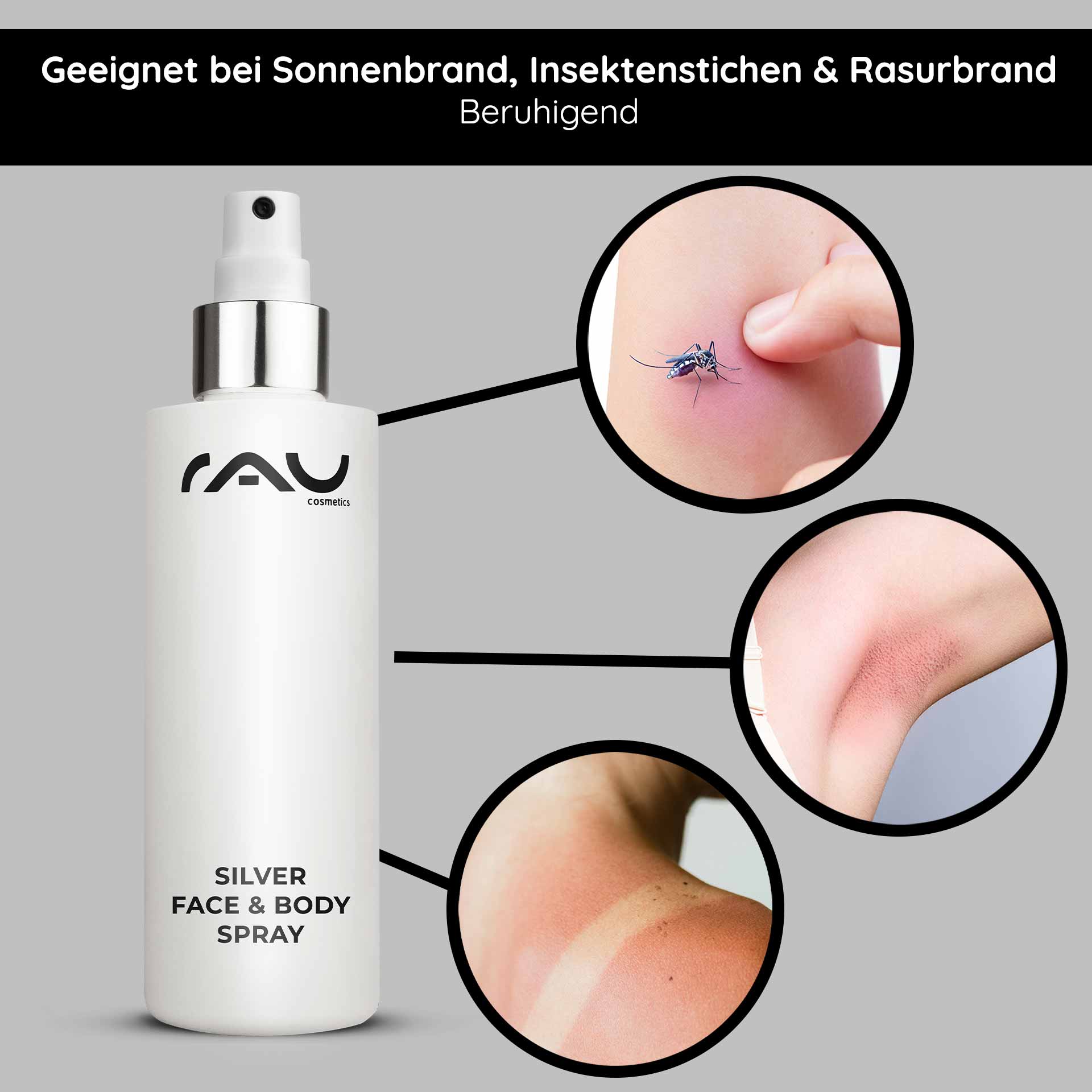 Silver Face & Body Spray 200 ml con Pantenol y Microplata Silver Face & Body Spray von RAU Cosmetics, geeignet zur Linderung von Sonnenbrand, Insektenstichen und Rasurbrand, mit sichtbaren Beispielen für Hautirritationen und einem eleganten Sprühflaschendesign.