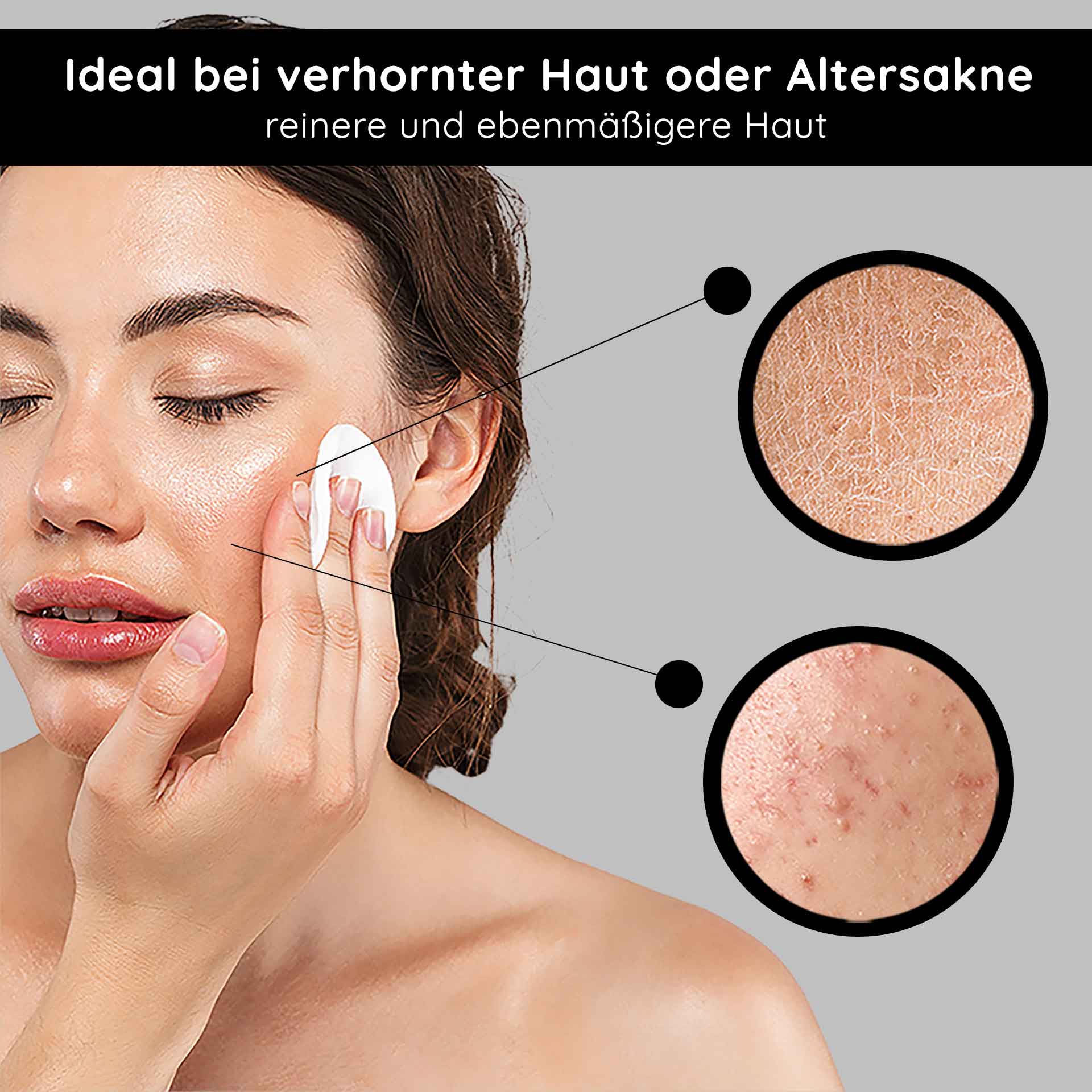 AHA Tonic 1000 ml tónico ácido suave de frutas Frau mit Wattepad, das AHA Tonic auf Gesicht aufträgt, ideal bei verhornter Haut oder Altersakne, zeigt Hautunreinheiten und Texturverbesserung.