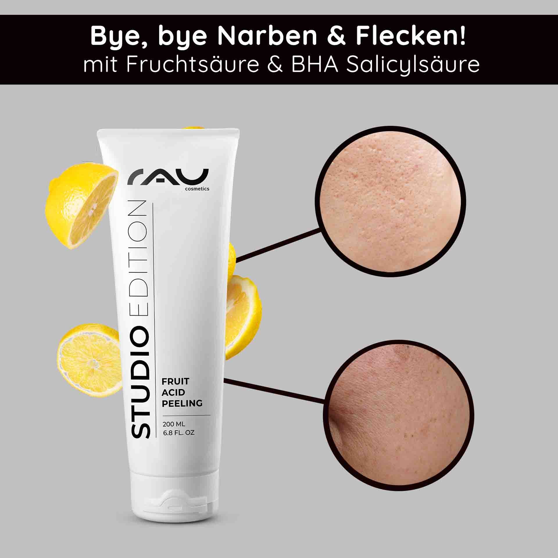 Tubo de exfoliante Fruit Acid Peeling de RAU Cosmetics con rodajas de limón, que resalta la mejora de la estructura de la piel y los beneficios del ácido salicílico BHA para reducir cicatrices e imperfecciones.