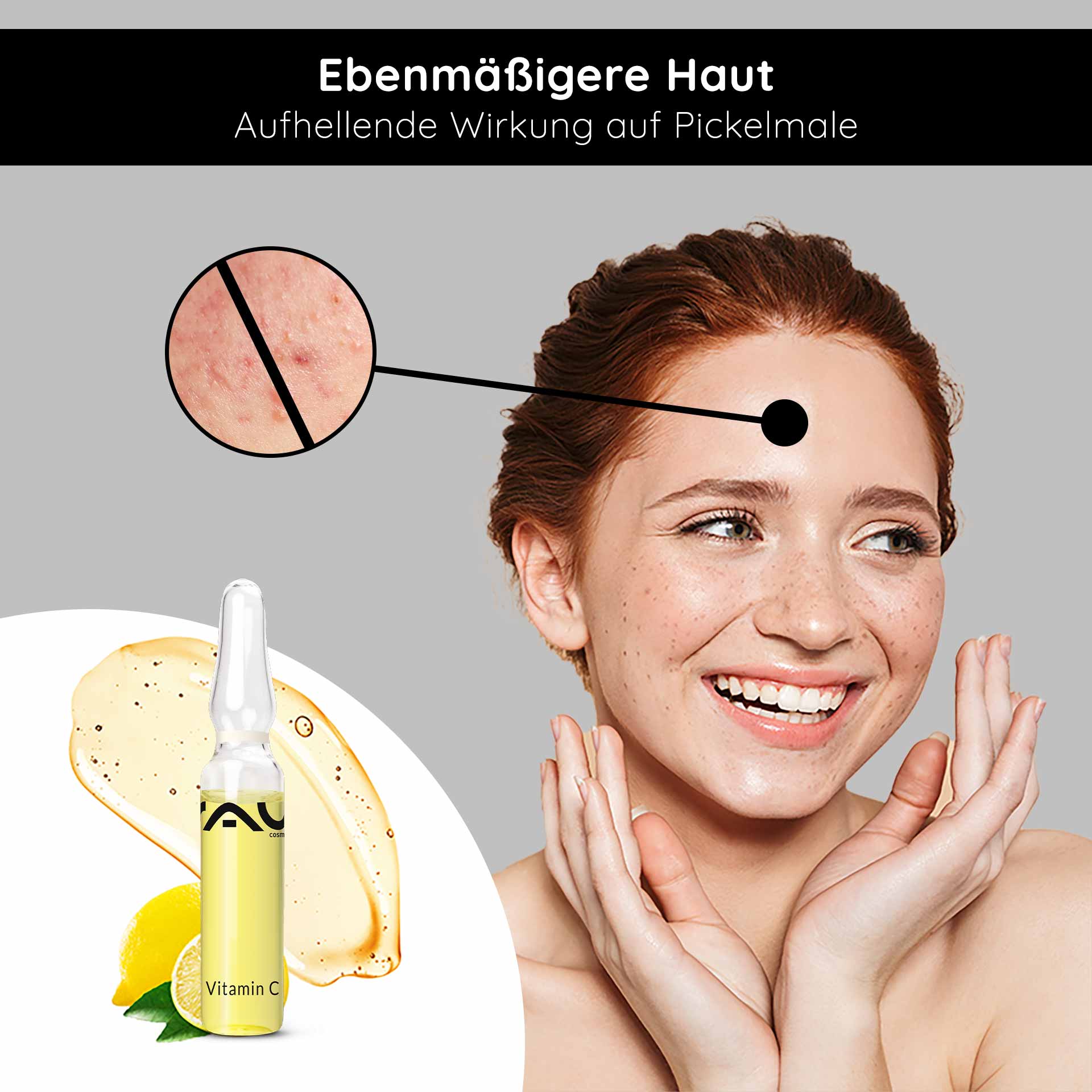 Ampollas de Vitamina C 14x2 ml para pieles maduras y con imperfecciones Vitamin C Ampullen von RAU Cosmetics, lächelnde Frau mit strahlender Haut, Hautunreinheiten im Fokus, aufhellende Wirkung, frische Zitrone und Serum abgebildet.