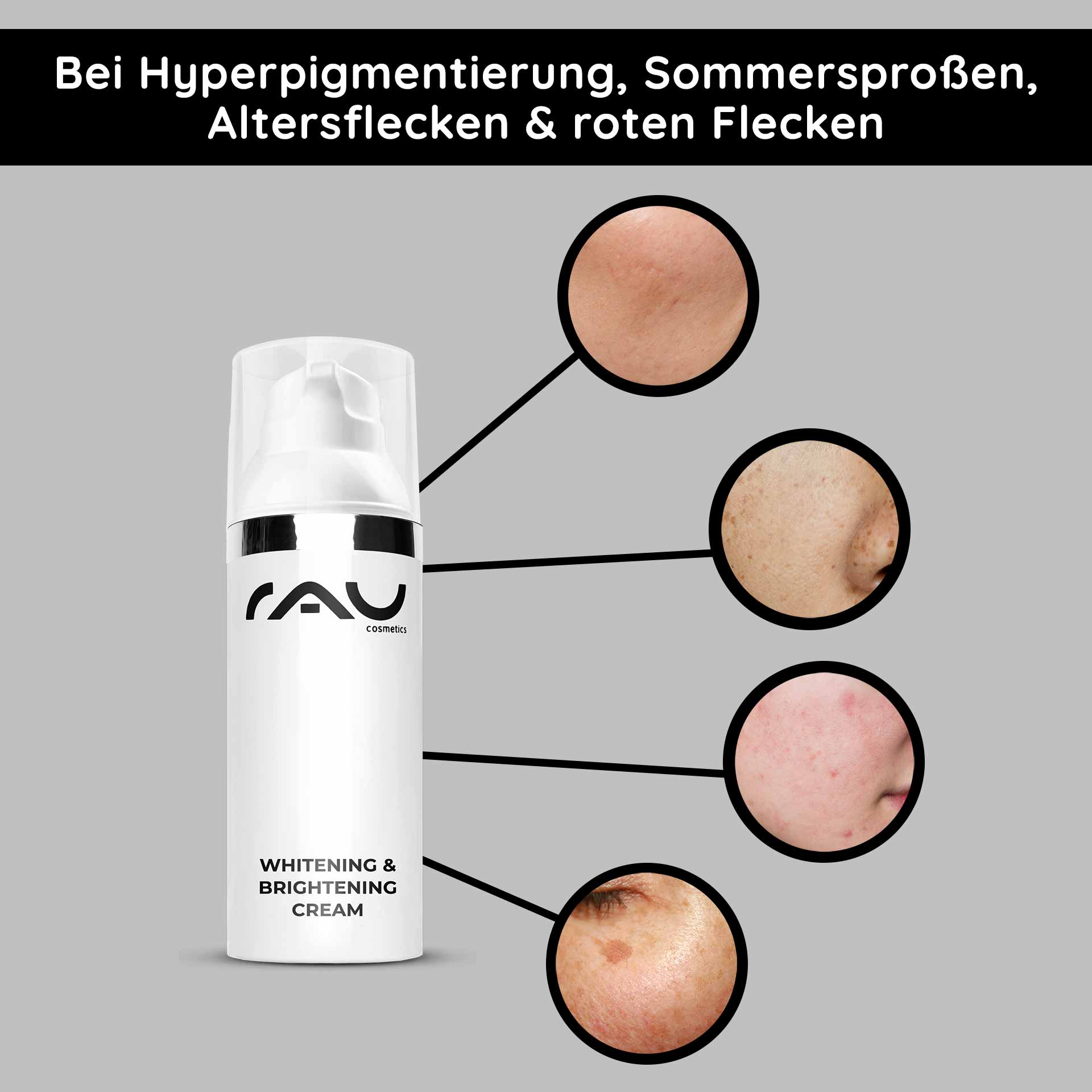 Crema blanqueadora e iluminadora 50 ml Aclarador de la piel Die Whitening & Brightening Cream von RAU Cosmetics hebt Hautunreinheiten wie Hyperpigmentierung, Altersflecken und rote Flecken hervor und zeigt wirksame Lösungen zur Hautaufhellung.
